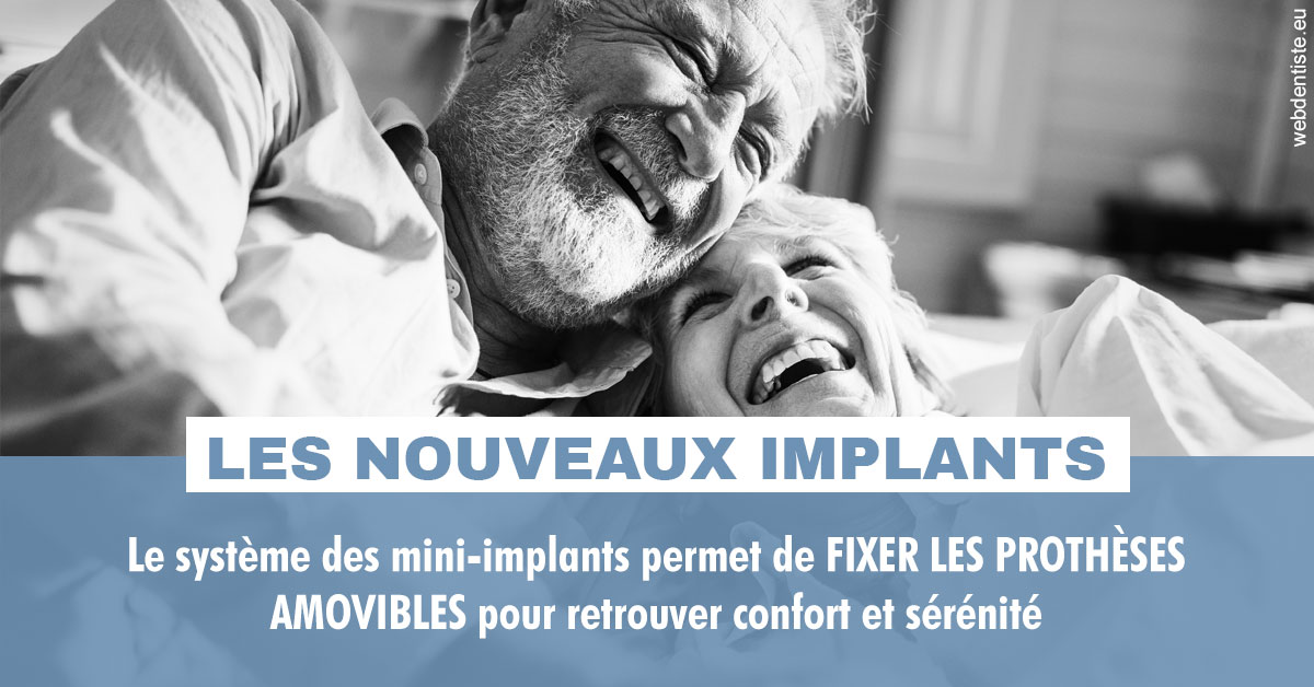 https://dr-deruelle-frederic.chirurgiens-dentistes.fr/Les nouveaux implants 2