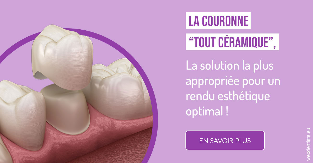 https://dr-deruelle-frederic.chirurgiens-dentistes.fr/La couronne "tout céramique" 2