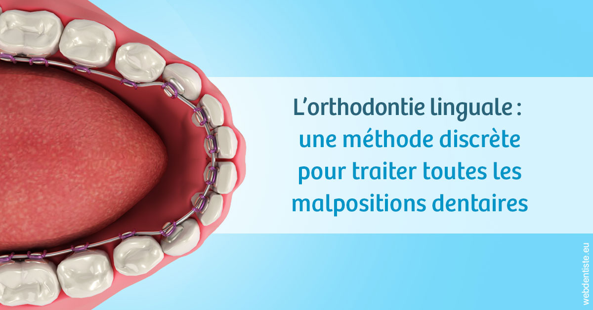 https://dr-deruelle-frederic.chirurgiens-dentistes.fr/L'orthodontie linguale 1