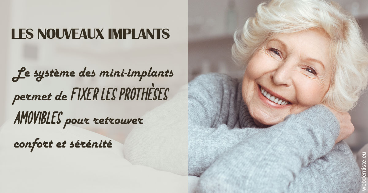 https://dr-deruelle-frederic.chirurgiens-dentistes.fr/Les nouveaux implants 1