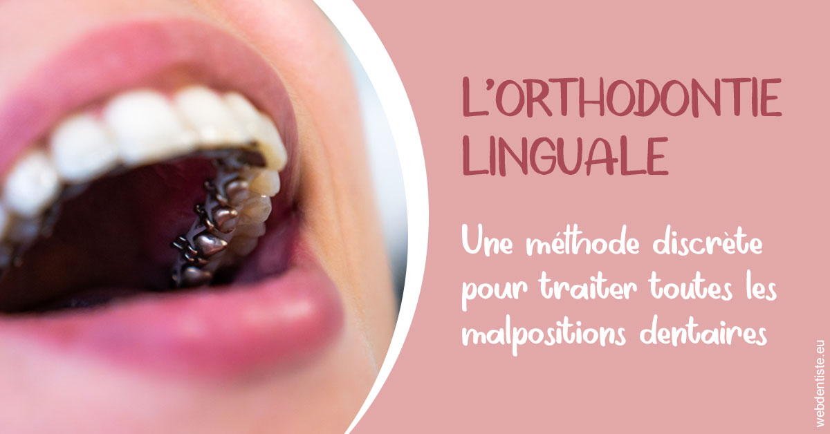 https://dr-deruelle-frederic.chirurgiens-dentistes.fr/L'orthodontie linguale 2