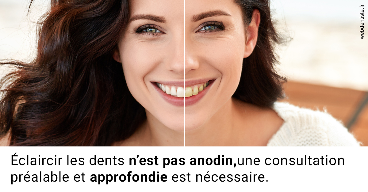 https://dr-deruelle-frederic.chirurgiens-dentistes.fr/Le blanchiment 2