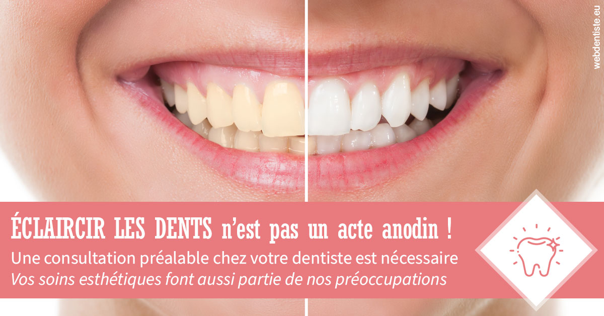 https://dr-deruelle-frederic.chirurgiens-dentistes.fr/Eclaircir les dents 1