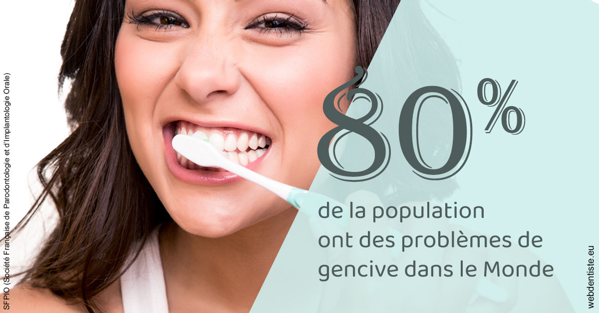 https://dr-deruelle-frederic.chirurgiens-dentistes.fr/Problèmes de gencive 1