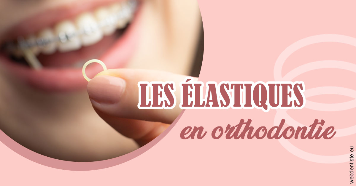 https://dr-deruelle-frederic.chirurgiens-dentistes.fr/Elastiques orthodontie 1