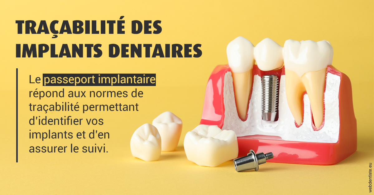 https://dr-deruelle-frederic.chirurgiens-dentistes.fr/T2 2023 - Traçabilité des implants 2