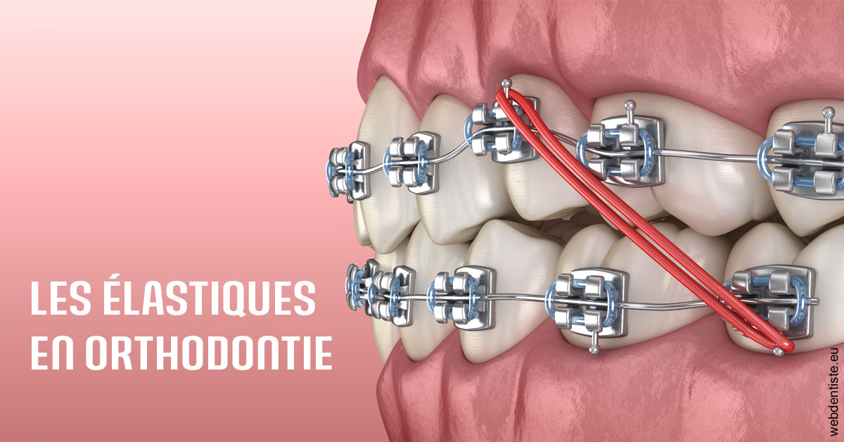 https://dr-deruelle-frederic.chirurgiens-dentistes.fr/Elastiques orthodontie 2