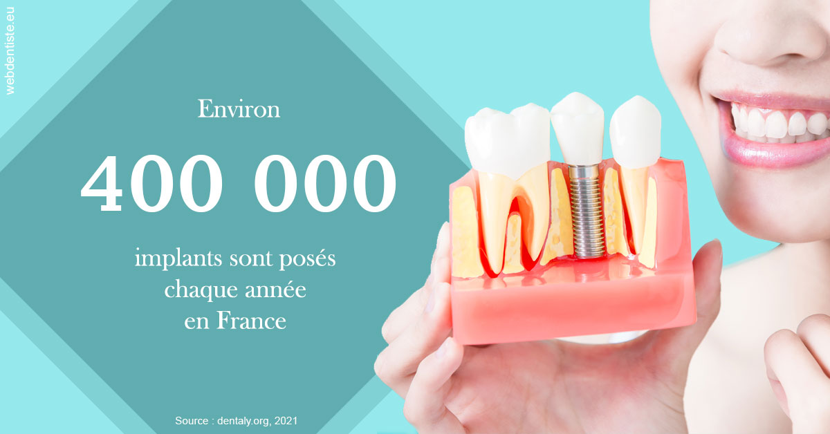 https://dr-deruelle-frederic.chirurgiens-dentistes.fr/Pose d'implants en France 2